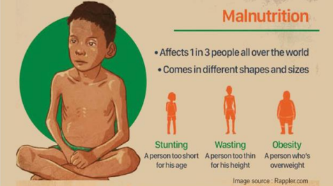 Malnutrition
